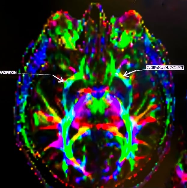 A close-up shot of brain scans highlighting activity in regions associated with positive emotions and reward when practicing gratitude. The scans are scientifically accurate.